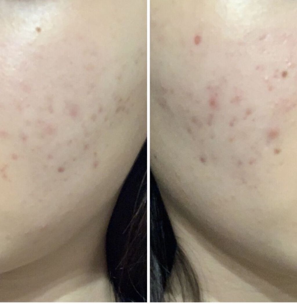 乳液・敏感肌用・さっぱりタイプ/無印良品/乳液を使ったクチコミ（3枚目）