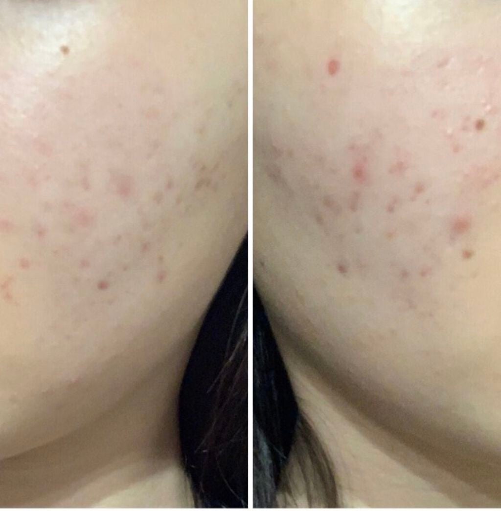 ハトムギ化粧水(ナチュリエ スキンコンディショナー R )/ナチュリエ/化粧水を使ったクチコミ(3枚目)