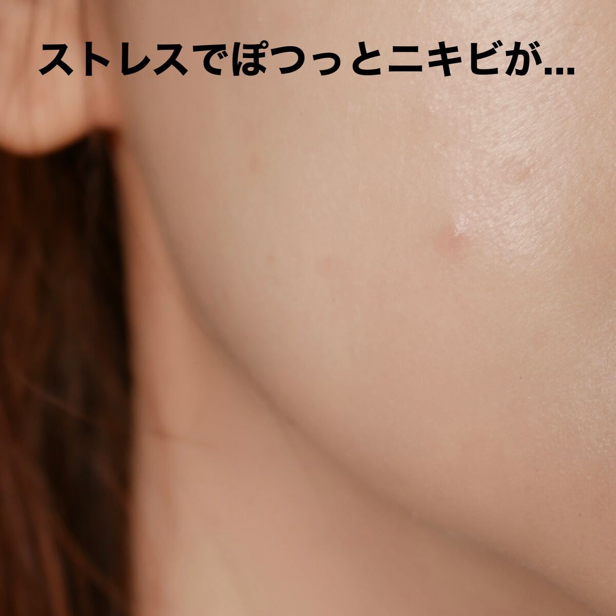 スキンコンディショニング セラム/プロアクティブ/フェイスクリームを使ったクチコミ（2枚目）