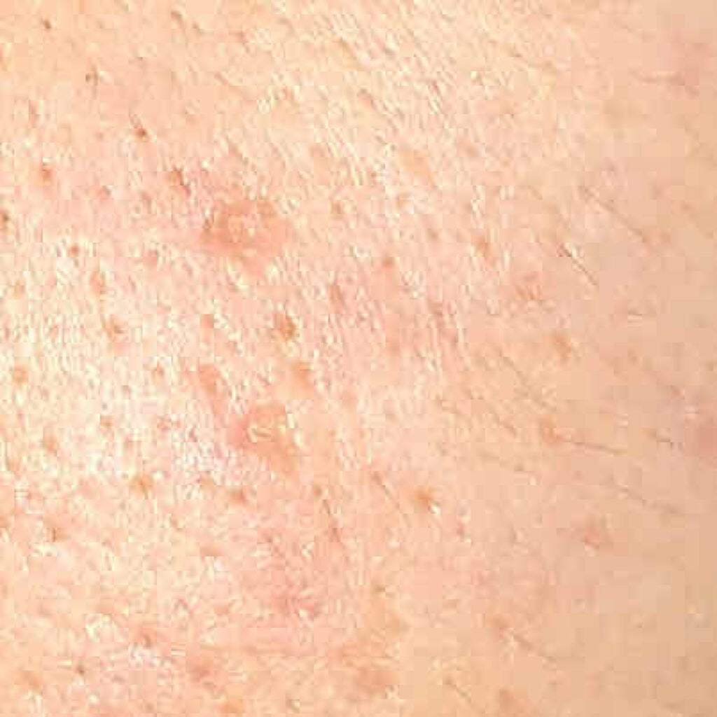 ネイチャーコンク 薬用クリアローション/ネイチャーコンク/拭き取り化粧水を使ったクチコミ(2枚目)