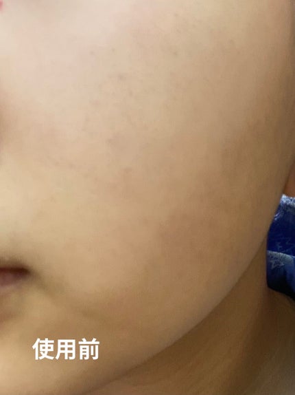 ドラマティックパウダリー EX/マキアージュ/パウダーファンデーションを使ったクチコミ(3枚目)