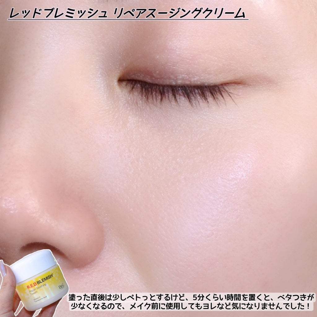 レッドブレミッシュ リペアスージングクリーム/Dr.G/フェイスクリームを使ったクチコミ(6枚目)