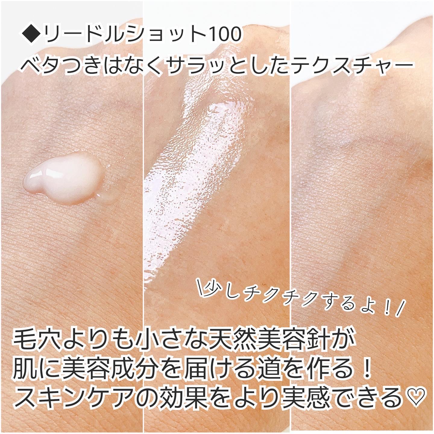 シカレチA エッセンス0.1/VT/美容液を使ったクチコミ（3枚目）