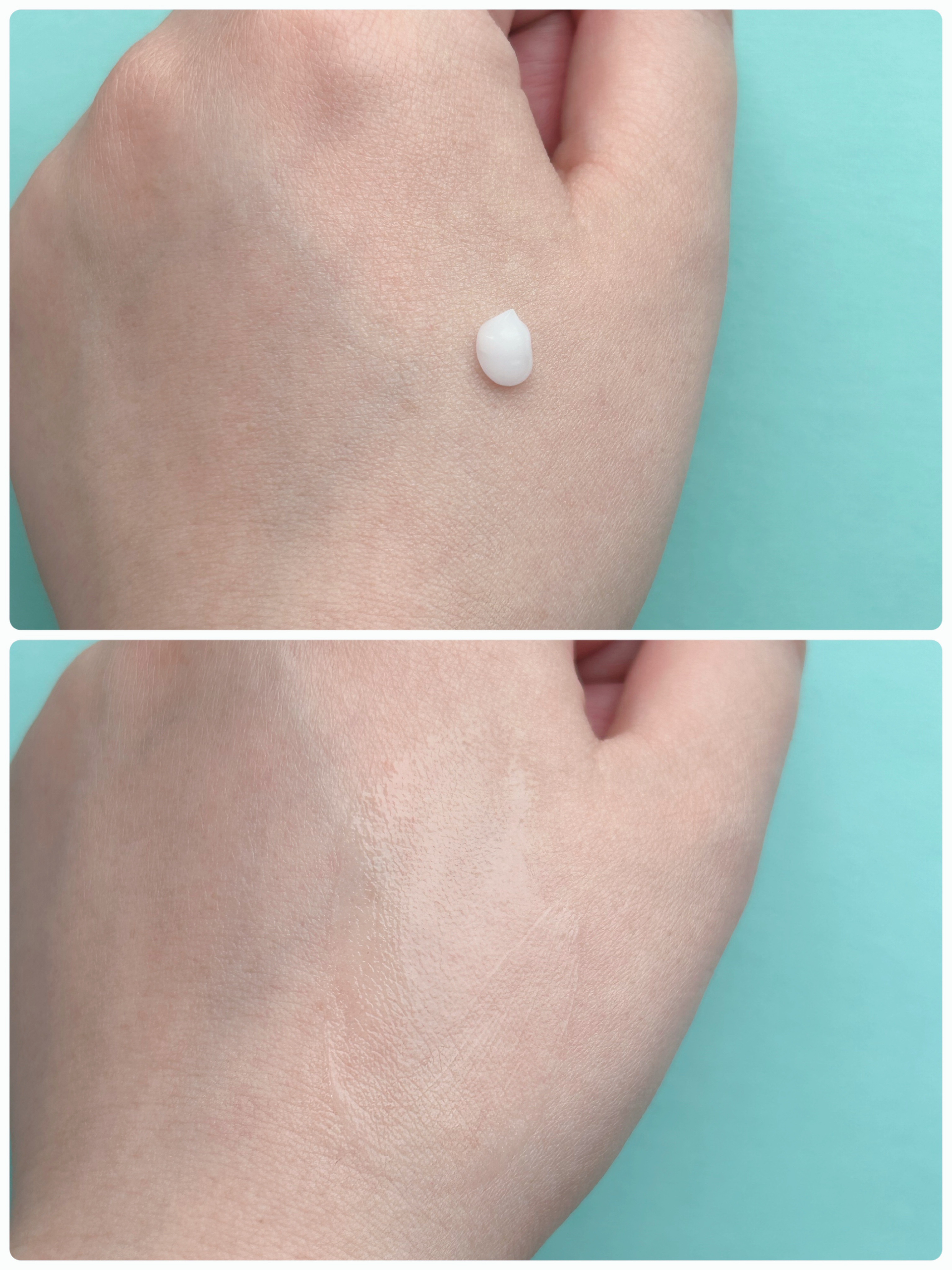 シカスポットクリーム/NATURAL DERMA PROJECT/フェイスクリームを使ったクチコミ（3枚目）