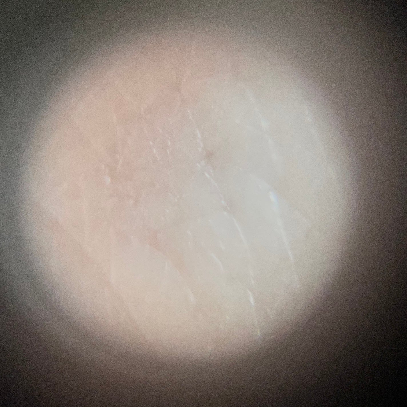 シカレチA エッセンス0.1/VT/美容液を使ったクチコミ(7枚目)