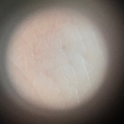 シカレチA エッセンス0.1/VT/美容液を使ったクチコミ(7枚目)