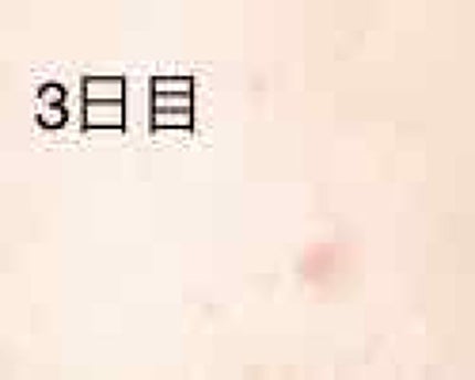 タカミスキンピール/タカミ/ブースター・導入液を使ったクチコミ(4枚目)