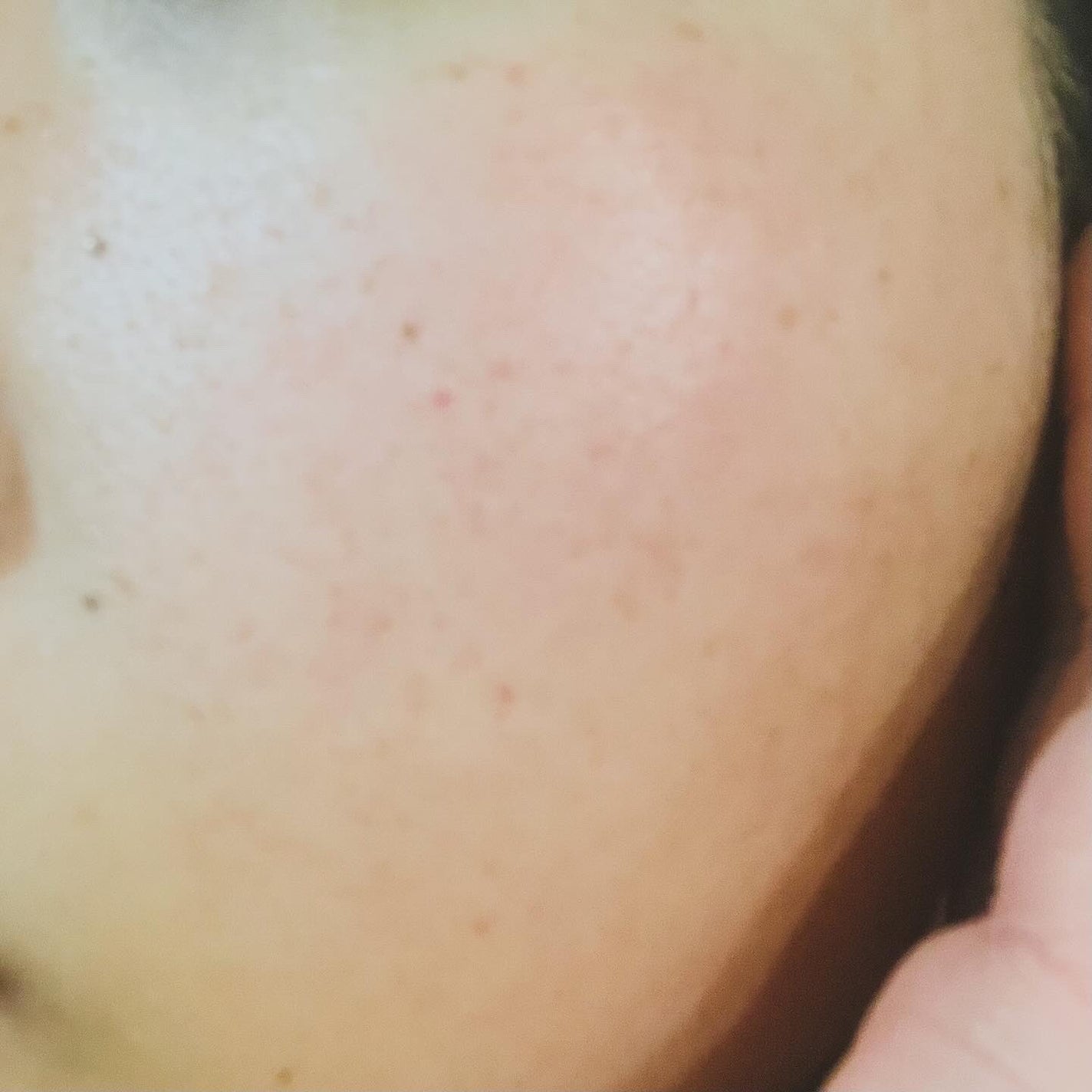 フォレストピトン水分CICAセラム/FoRest by Greenfinger/美容液を使ったクチコミ(4枚目)