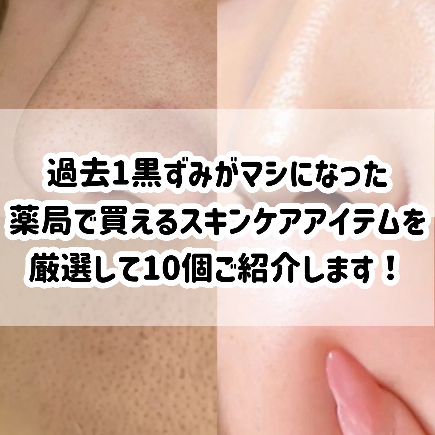 潤浸保湿 乳液/キュレル/乳液を使ったクチコミ(2枚目)