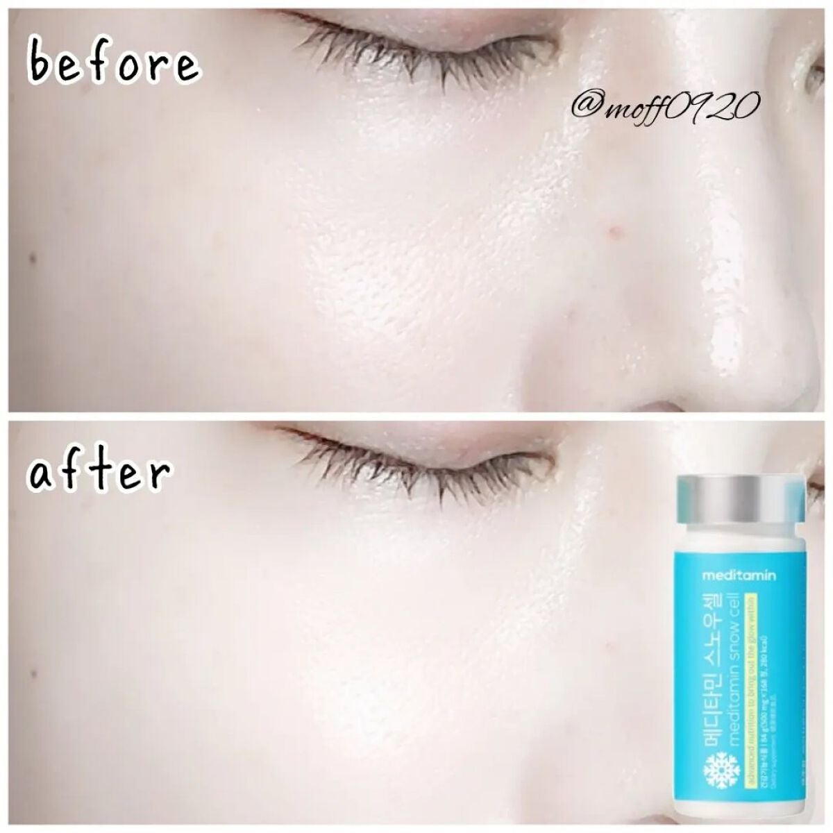 スノーセル/メディタミン/美容サプリメントを使ったクチコミ(4枚目)
