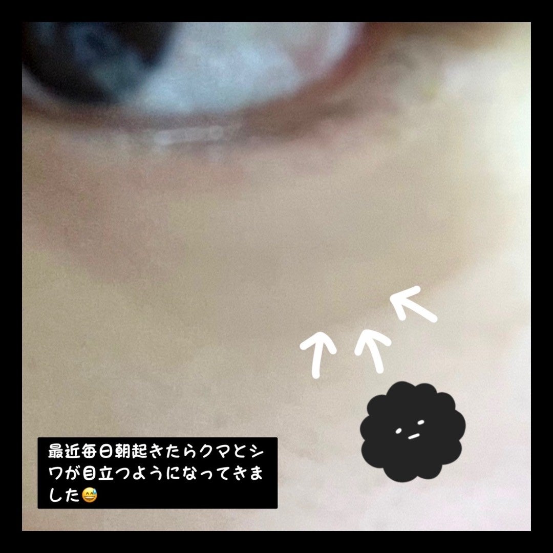 薬用リンクルアイクリーム ホワイト/なめらか本舗/アイケア・アイクリームを使ったクチコミ(2枚目)