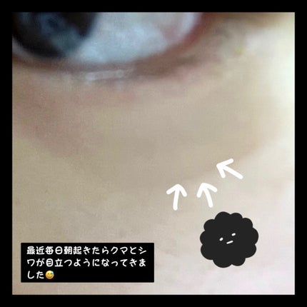 薬用リンクルアイクリーム ホワイト/なめらか本舗/アイケア・アイクリームを使ったクチコミ(2枚目)