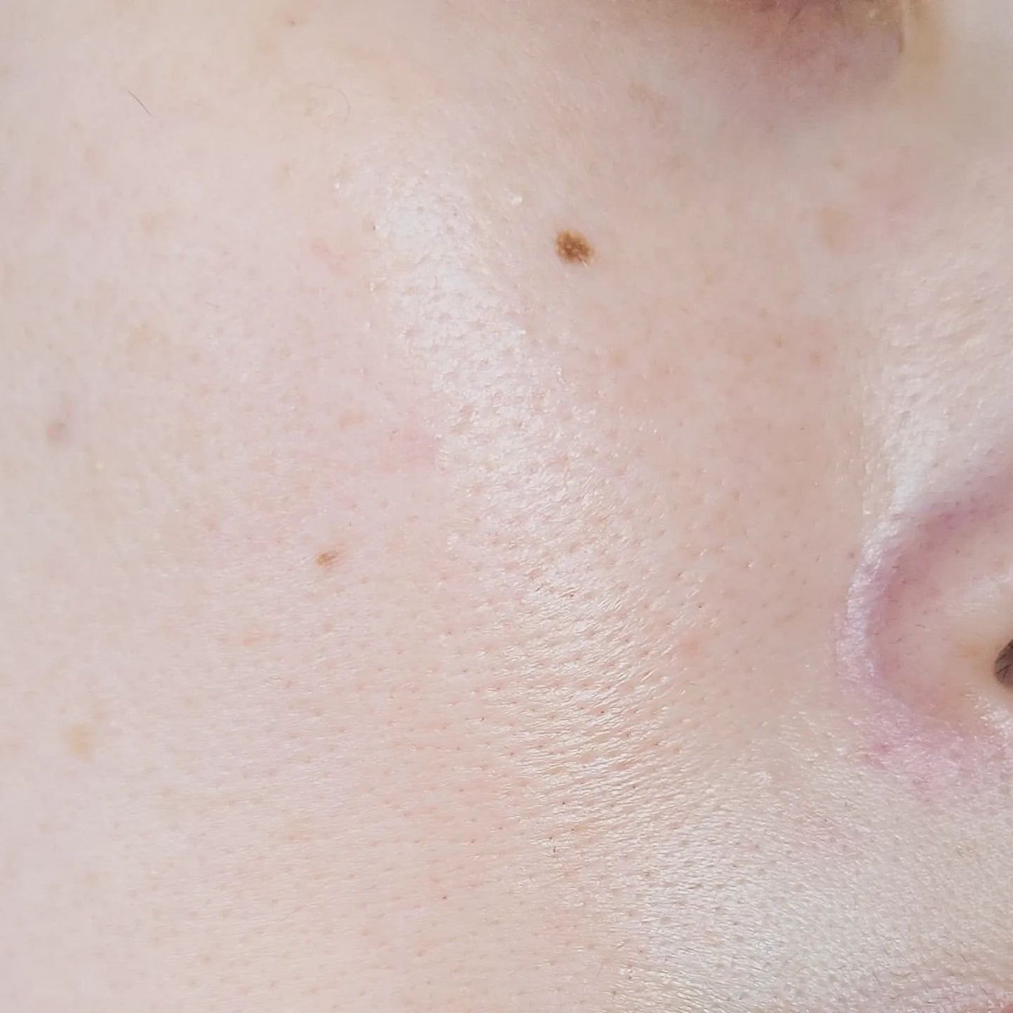 ロイヤルリミテッド/ビービーラボラトリーズ/美容液を使ったクチコミ(10枚目)