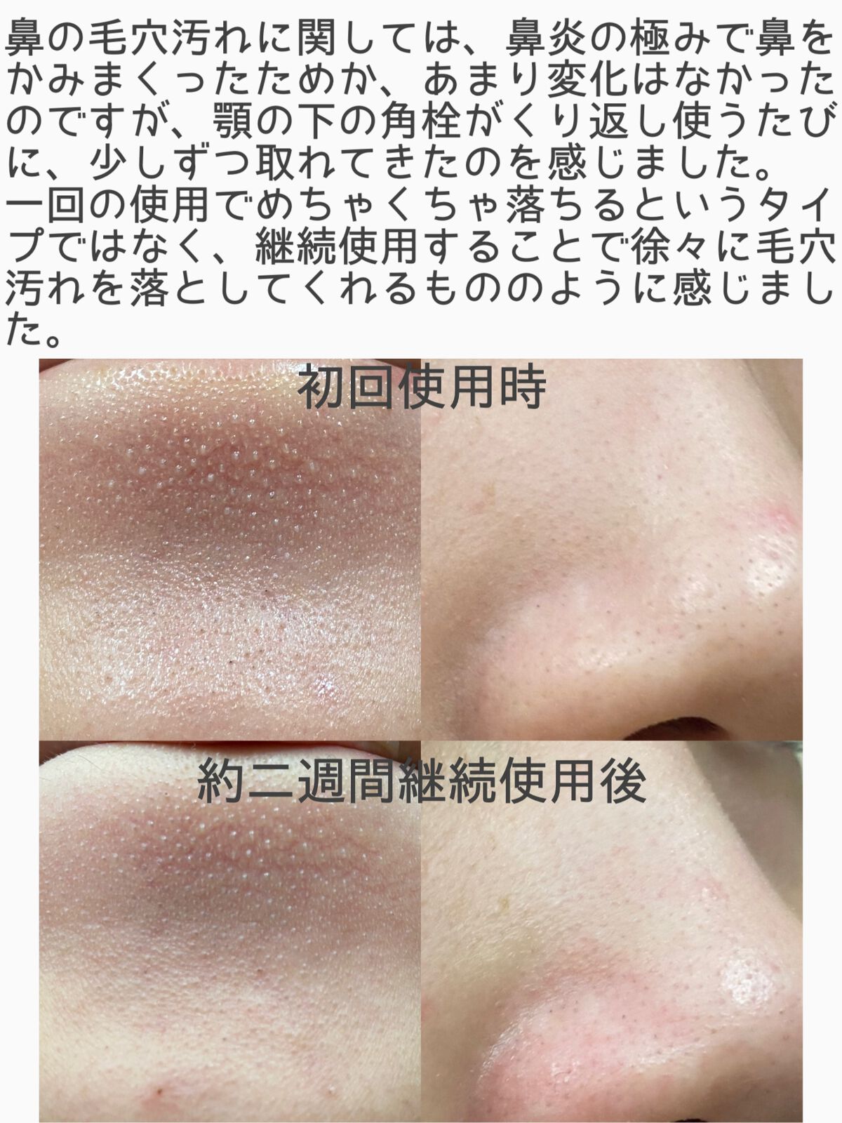 マイルドクレンジング オイル〈ブラック&スムース〉/ファンケル/オイルクレンジングを使ったクチコミ(3枚目)