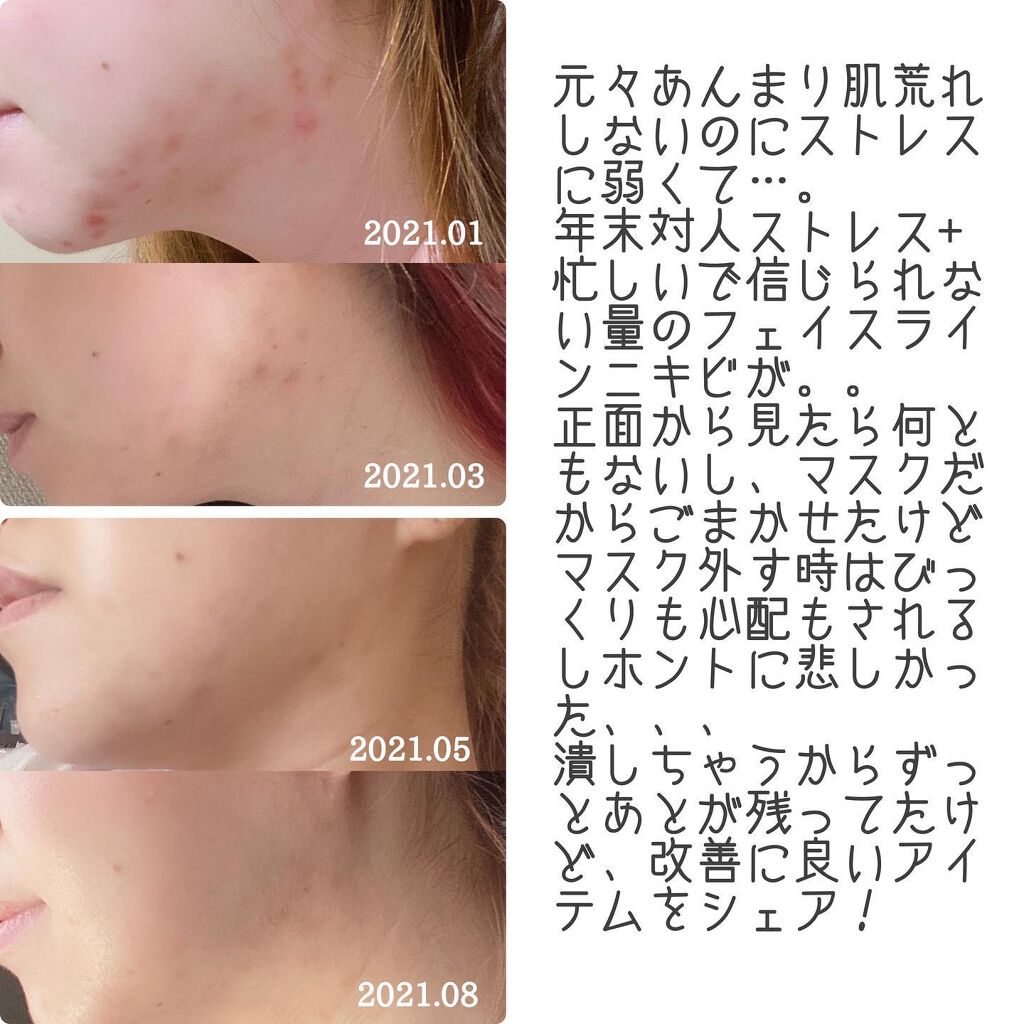 ディープクリア洗顔パウダー/ファンケル/洗顔パウダーを使ったクチコミ(2枚目)