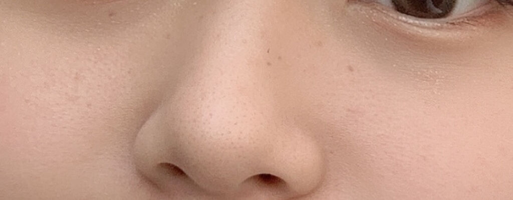 ハトムギ化粧水(ナチュリエ スキンコンディショナー R )/ナチュリエ/化粧水を使ったクチコミ（2枚目）