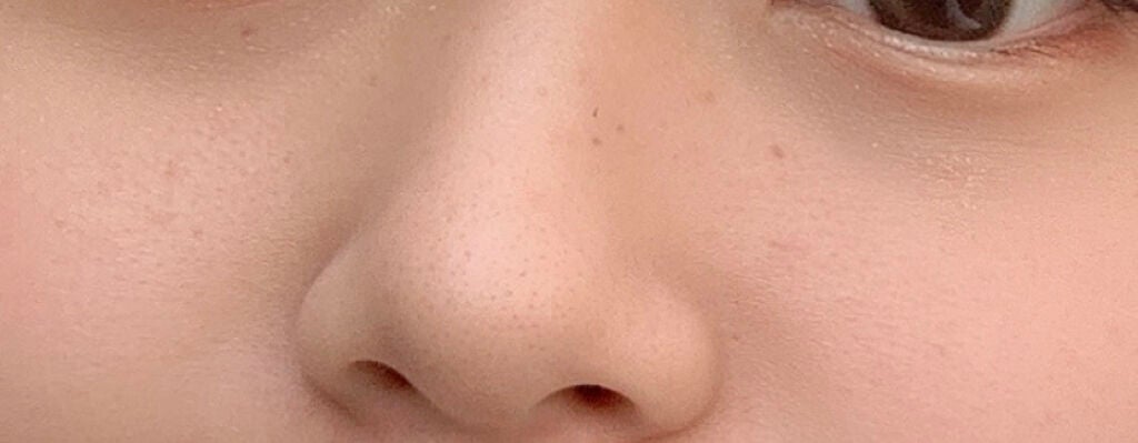 ハトムギ化粧水(ナチュリエ スキンコンディショナー R )/ナチュリエ/化粧水を使ったクチコミ(2枚目)