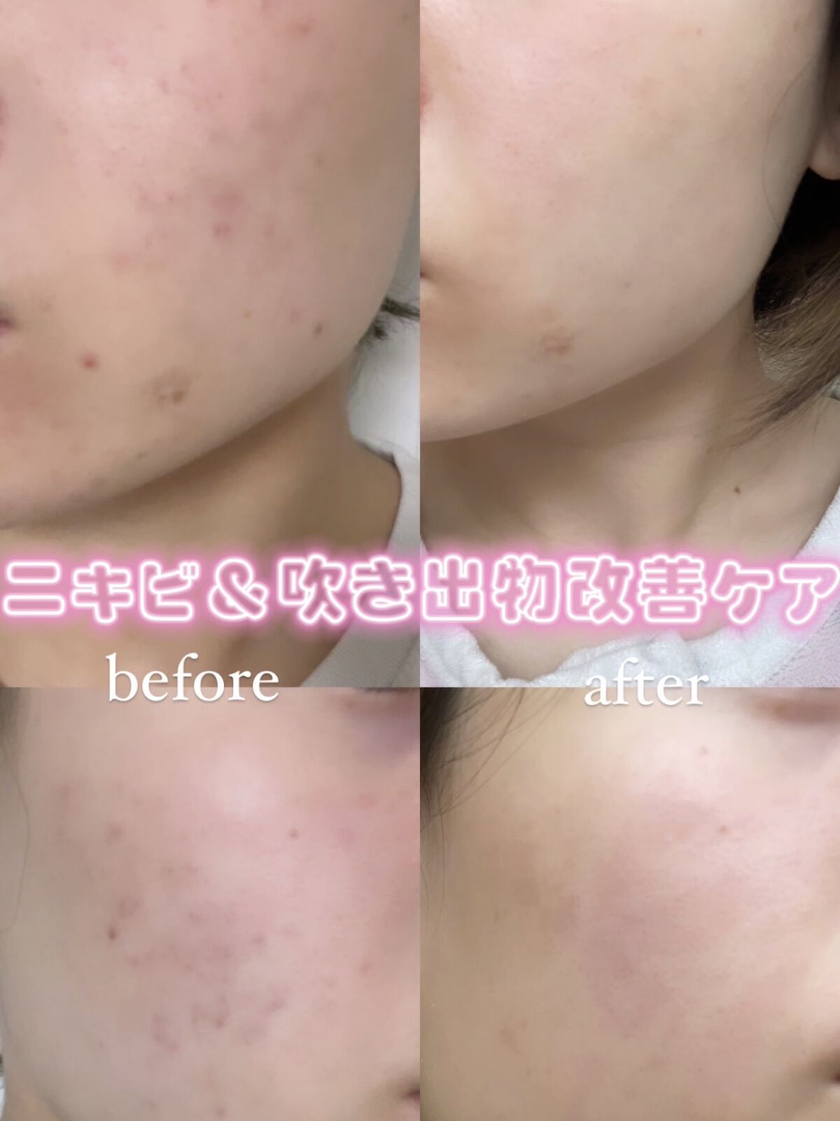 お米のマスク/毛穴撫子/シートマスク・パックを使ったクチコミ（1枚目）