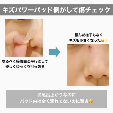 キズパワーパッド/バンドエイド/その他を使ったクチコミ(3枚目)