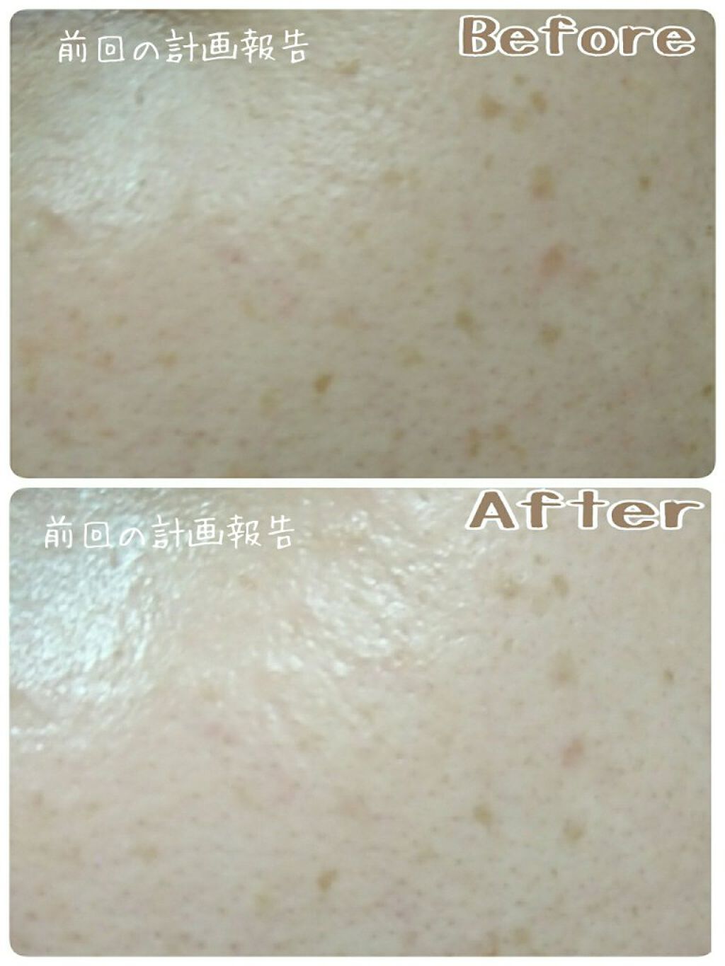 エリクシール ホワイト リセット ブライトニスト/エリクシール/フェイスクリームを使ったクチコミ(3枚目)