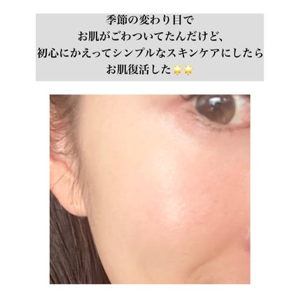 皮脂トラブルケア 化粧水/キュレル/化粧水を使ったクチコミ(5枚目)