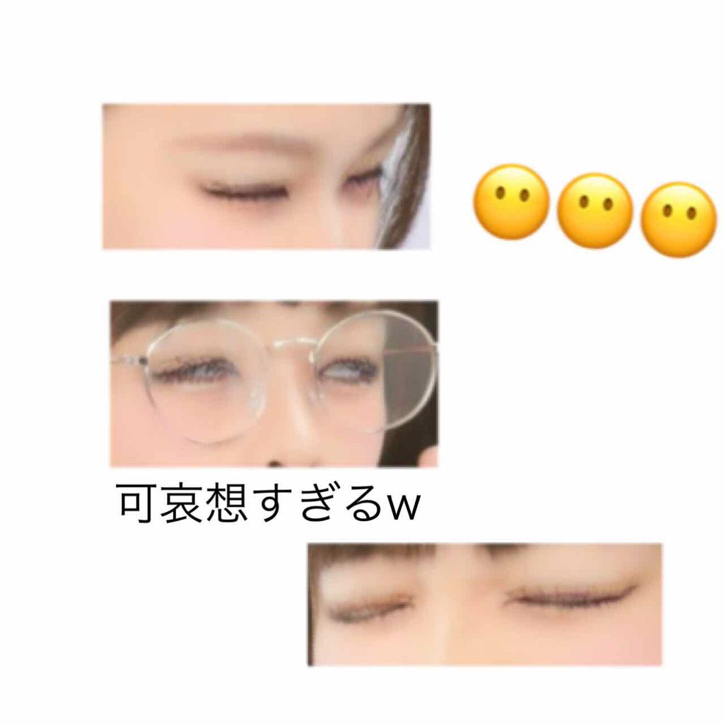 Haruka on LIPS 「今回は、整形(埋没)についてお話します!※最後に伝えたいこと書..」(2枚目)