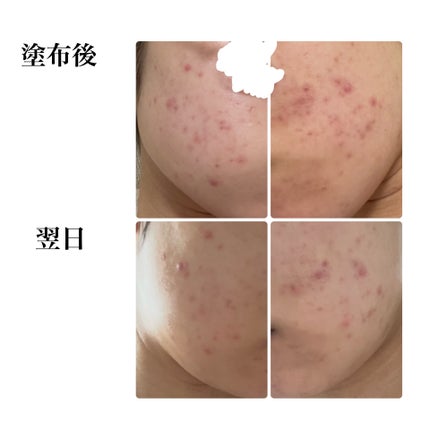 CICA スリーピングマスク/VT/シートマスク・パックを使ったクチコミ(3枚目)