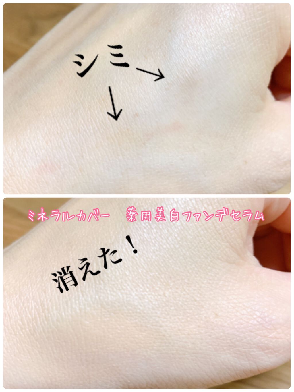 ミネラルカバー薬用美白ファンデセラム/ミリオナ化粧品/美容液を使ったクチコミ(4枚目)