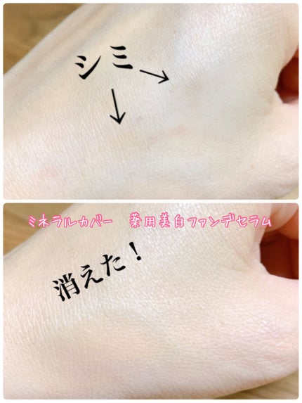 ミネラルカバー薬用美白ファンデセラム/ミリオナ化粧品/美容液を使ったクチコミ(4枚目)