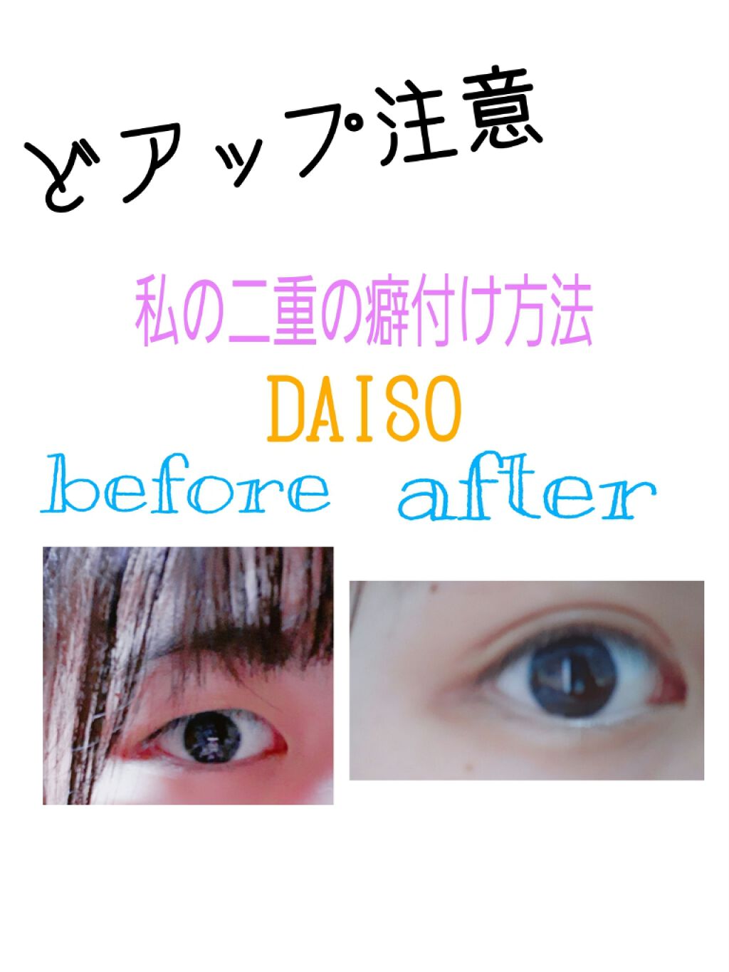 二重まぶた用シール/DAISO/二重まぶた用アイテムを使ったクチコミ（1枚目）