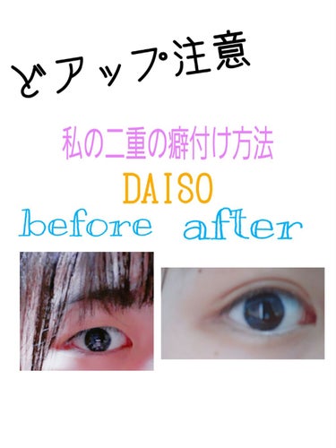 のび〜る アイテープ 両面テープタイプ/DAISO/二重まぶた用アイテムを使ったクチコミ（1枚目）