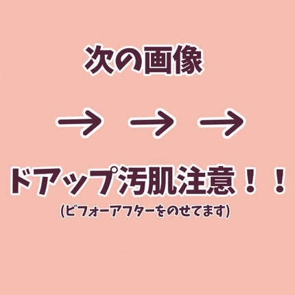 ローションシート(部分用)/無印良品/その他スキンケアグッズを使ったクチコミ(5枚目)