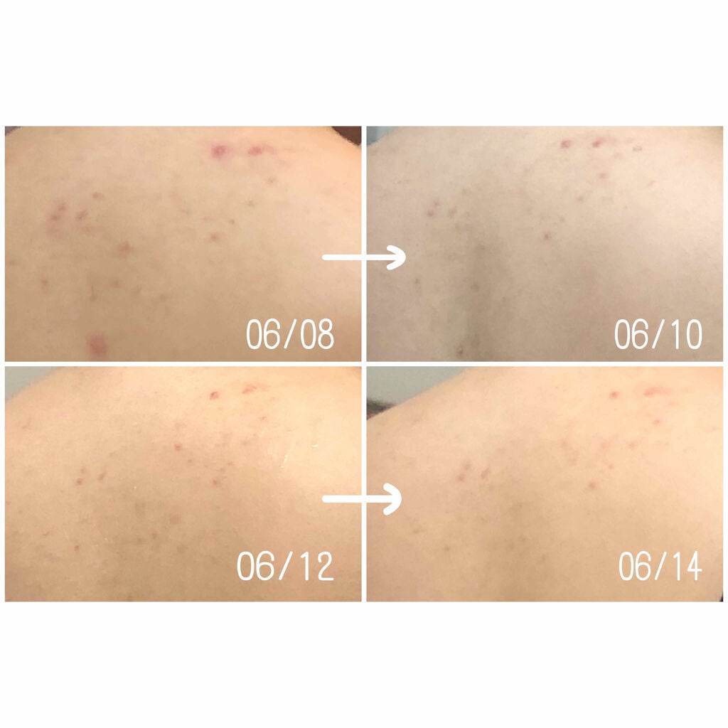 セナキュア(医薬品)/小林製薬/その他を使ったクチコミ(3枚目)