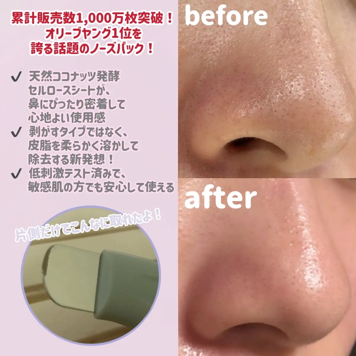 ナチュラルマイルドクリアノーズパック/ilso/シートマスク・パックを使ったクチコミ（3枚目）