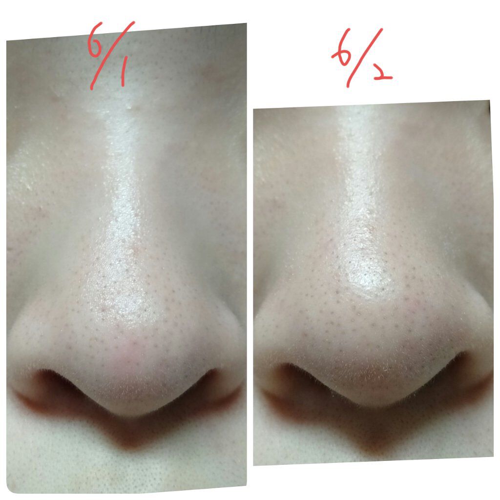 リアルカレンデュラピールオフパック/APRILSKIN/ピーリングを使ったクチコミ（3枚目）