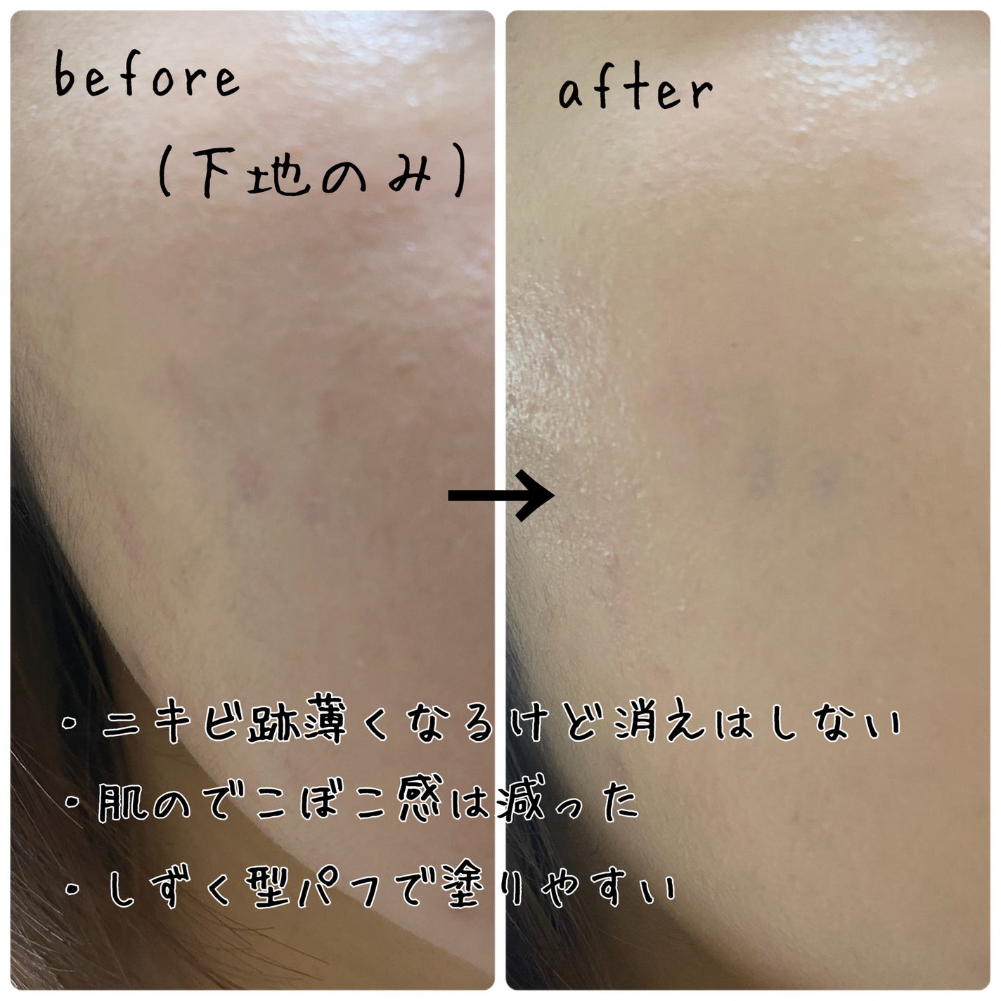 セラムフィット フルカバー グロークッション/ByUR/クッションファンデーションを使ったクチコミ(4枚目)