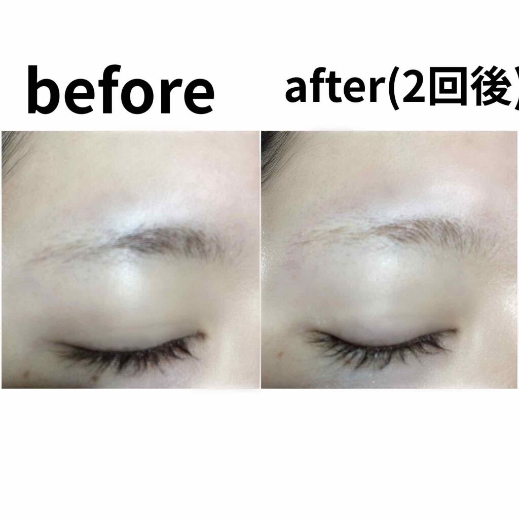 脱色クリーム 敏感肌用/エピラット/ムダ毛ケアを使ったクチコミ（2枚目）