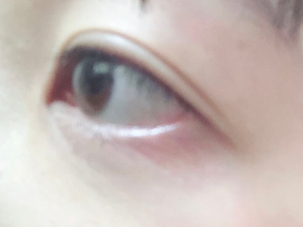 ロート アルガード クリアブロックZ(医薬品)/ロート製薬/その他を使ったクチコミ(1枚目)