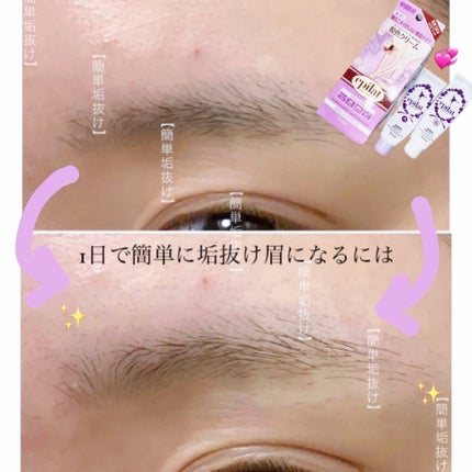 脱色クリーム 敏感肌用 脱色クリーム(敏感肌用)【旧】/エピラット/ムダ毛ケアを使ったクチコミ(1枚目)