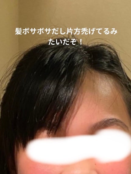 アコアコ♡ on LIPS 「アコアコ♡です!今回は私の前髪垢抜け日記を紹介したいと思います..」(3枚目)