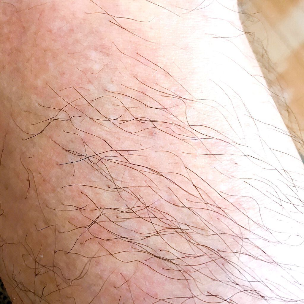 NONON/NONON(ノンノン)/除毛クリームを使ったクチコミ(4枚目)