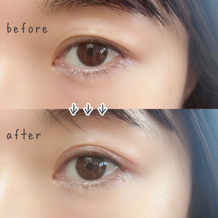 まぶたリフト美容液ハリピンシャドウ/Dr.CELLBEAUTÉ/美容液を使ったクチコミ(2枚目)