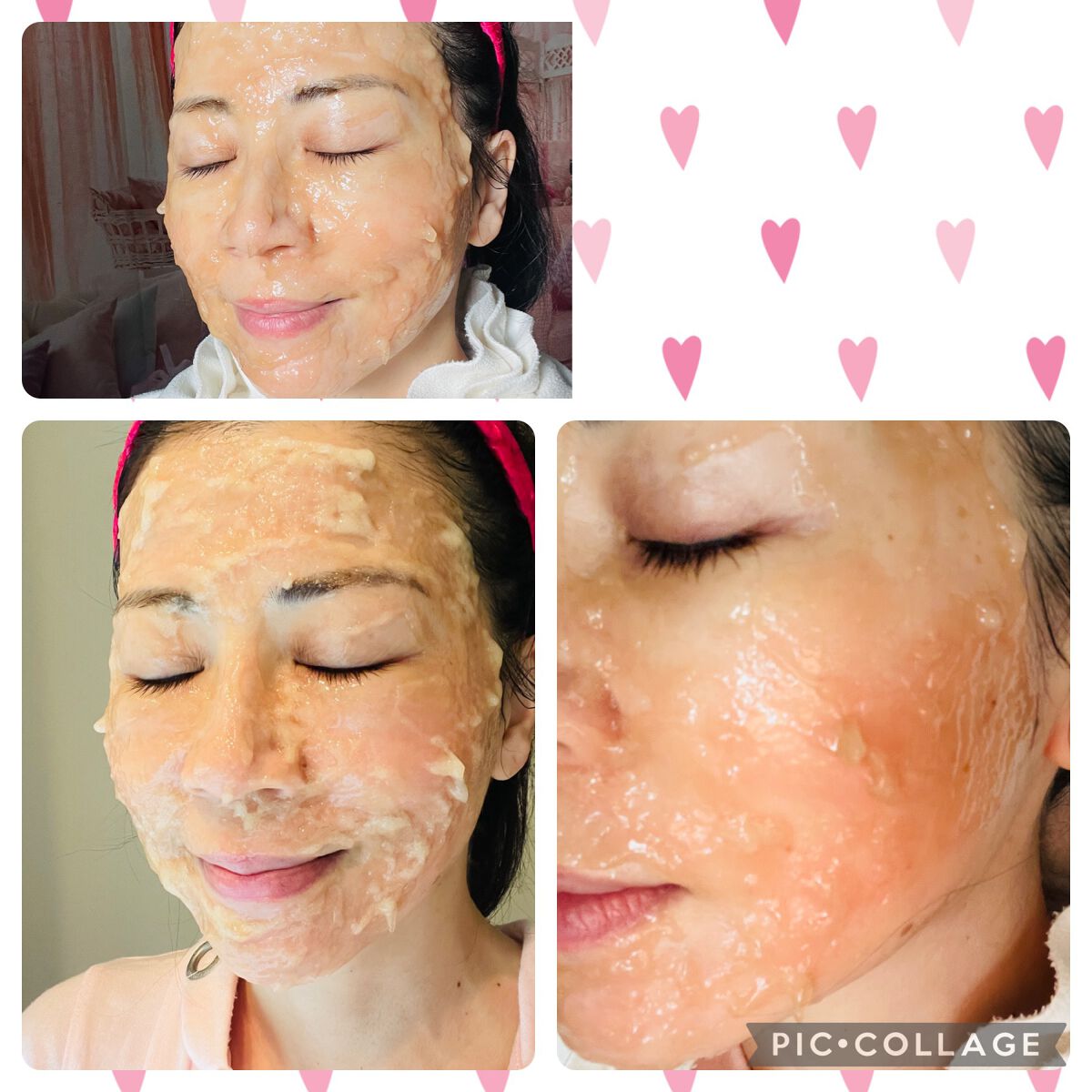 メディプローラー CO2ジェルマスク/ドクターメディオン/洗い流すパック・マスクを使ったクチコミ(5枚目)