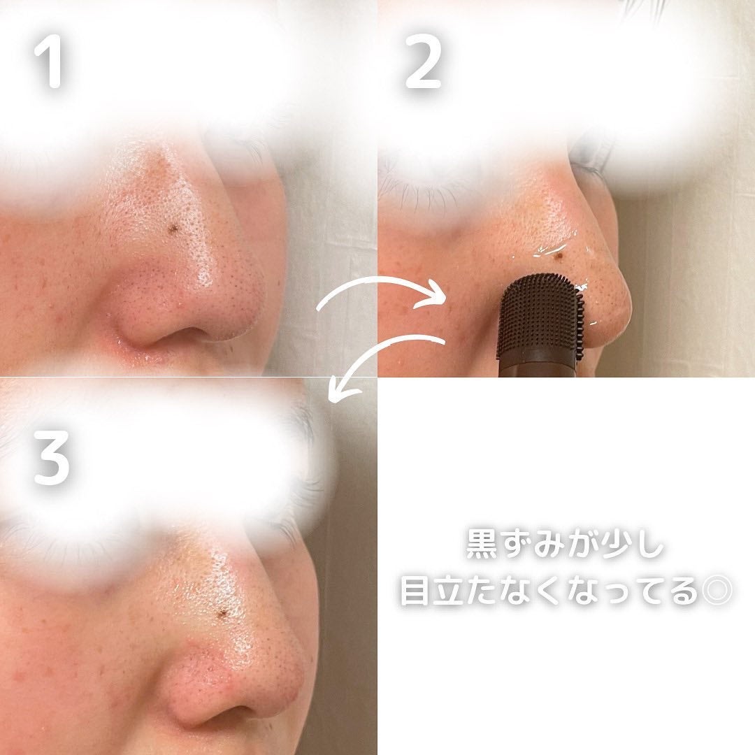 チョコブラ スペシャル毛穴ケアセット/Chocobra/スキンケアキットを使ったクチコミ(5枚目)