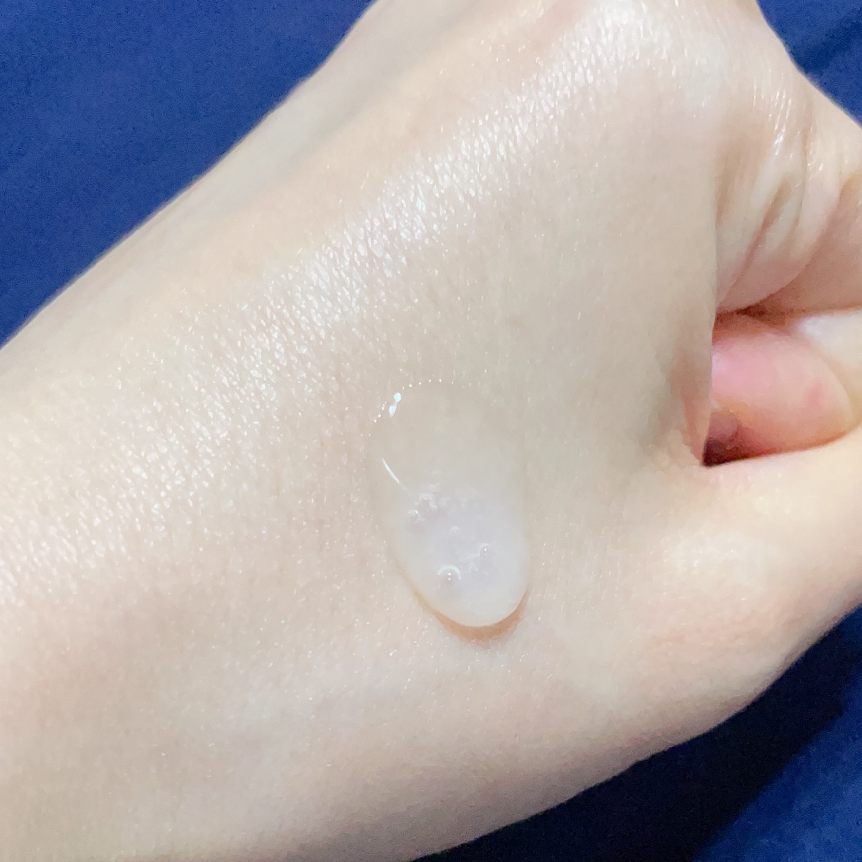 エイシカ365 ブレミッシュカーミングセラム/AESTURA/美容液を使ったクチコミ（2枚目）