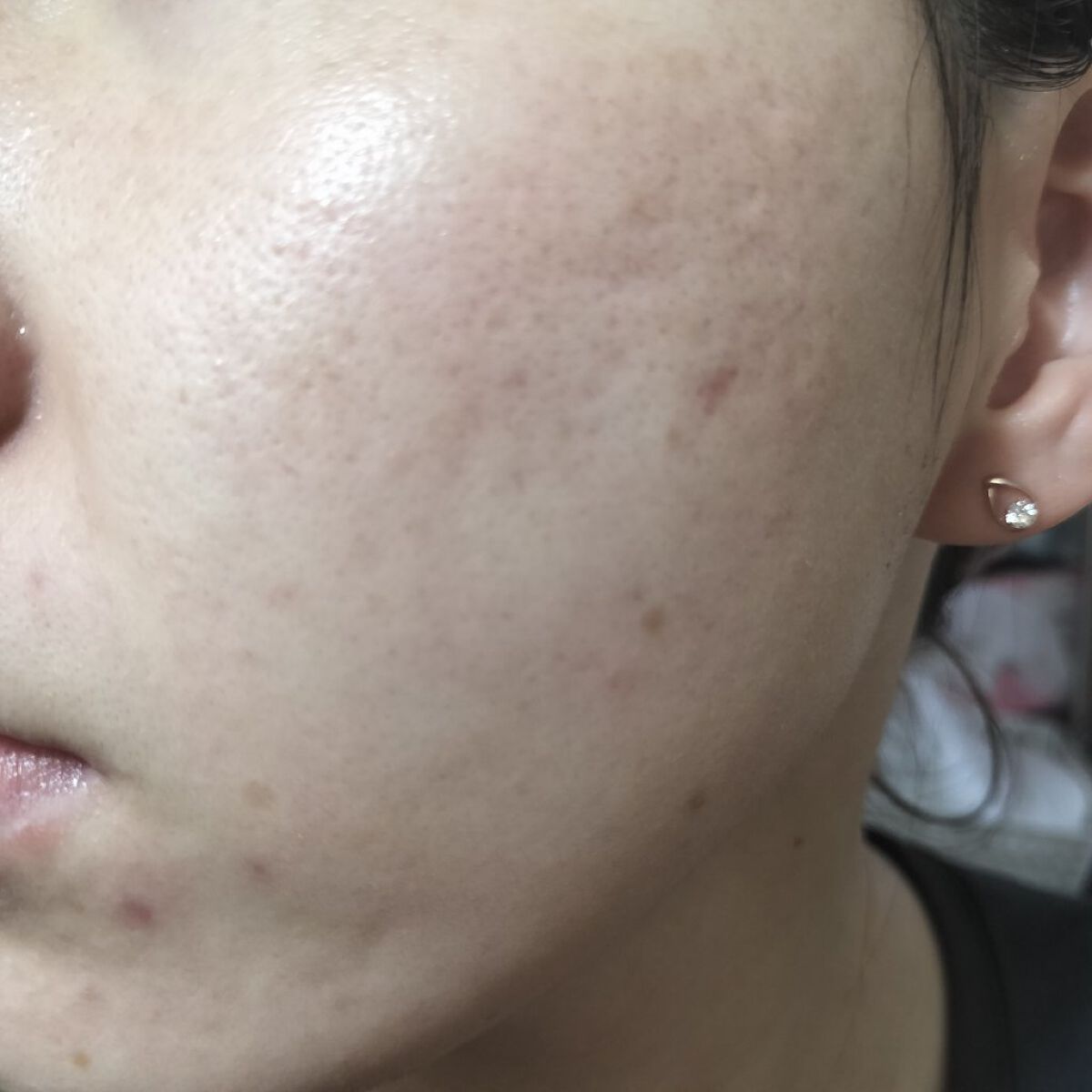 レチノールA 1% アドバンスドリバイタリゼーションクリーム/Life-flo/フェイスクリームを使ったクチコミ（2枚目）