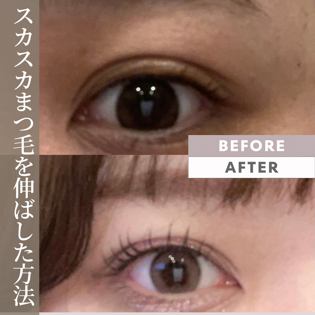 ラッシュアディクト アイラッシュコンディショニングセラム/soaddicted/まつげ美容液を使ったクチコミ（1枚目）