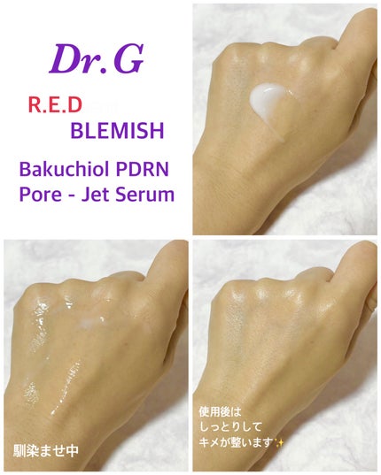 バクチオールポアジェットセラム/Dr.G/美容液を使ったクチコミ(4枚目)