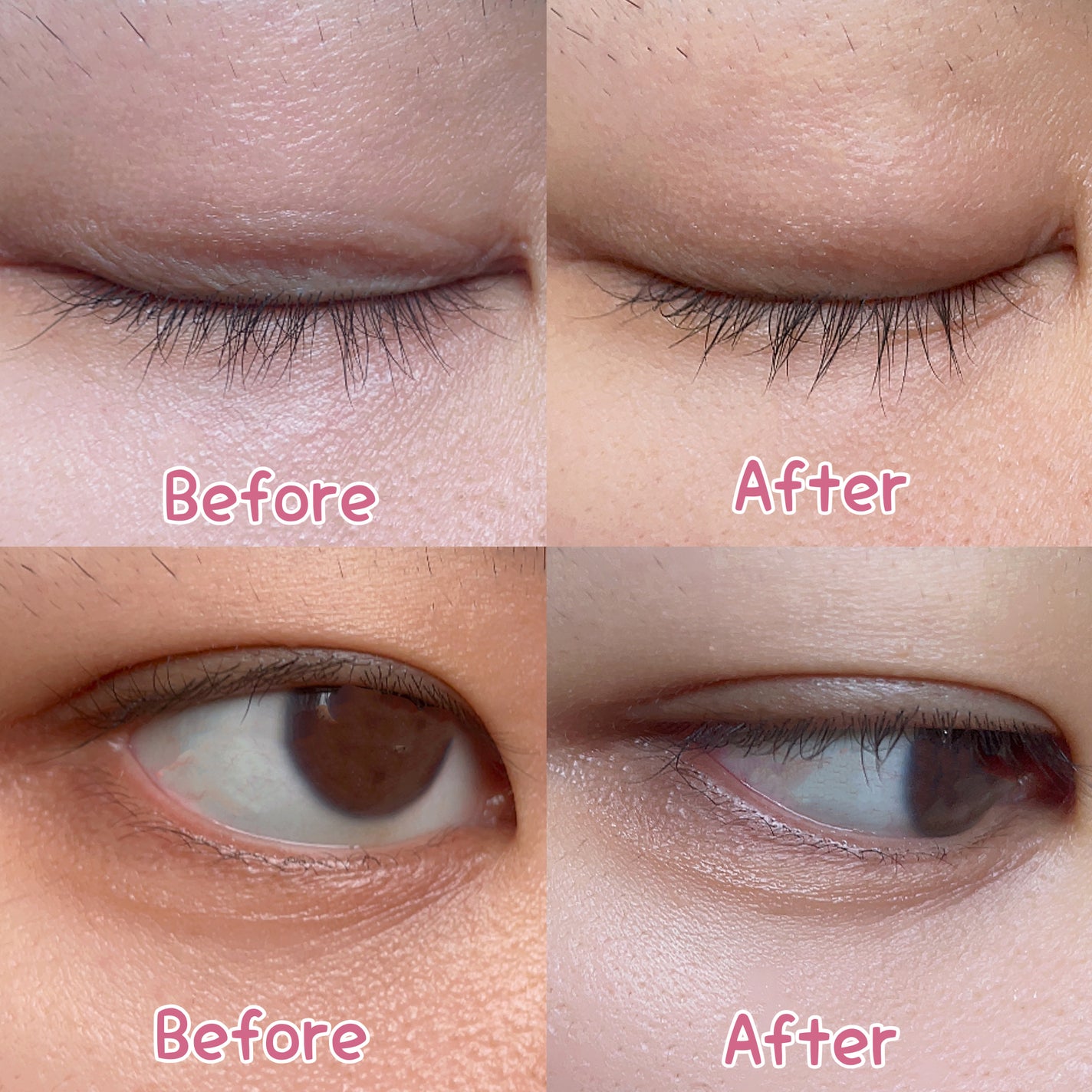 ごめんね素肌 クマらないアイクリーム/クリアターン/アイケア・アイクリームを使ったクチコミ(6枚目)