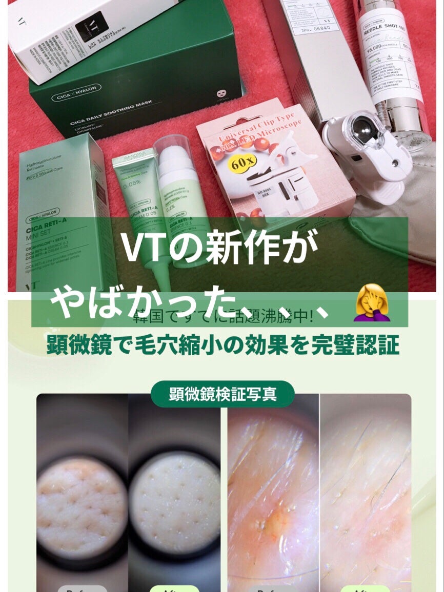 シカレチA エッセンス0.1/VT/美容液を使ったクチコミ(1枚目)